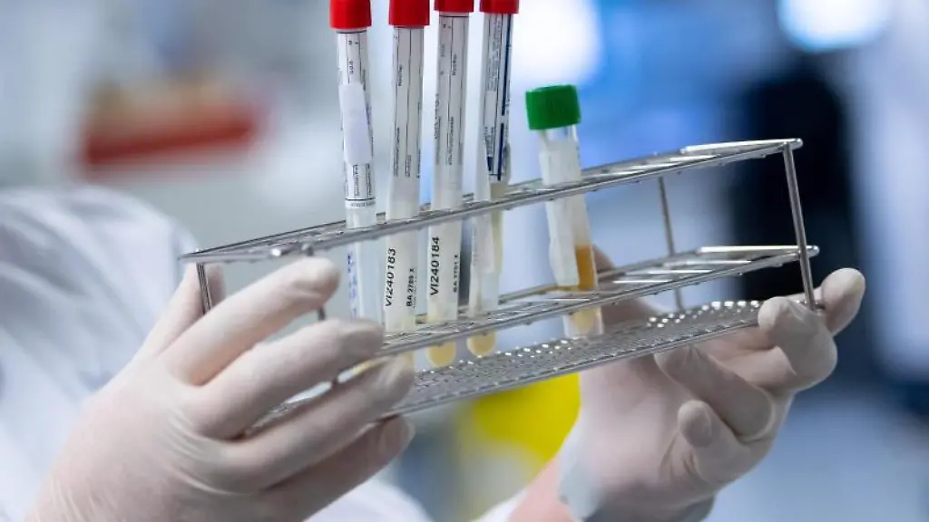 Eine-Laborantin-bereitet-Corona-Proben-fuer-die-weitere-Analyse-vor