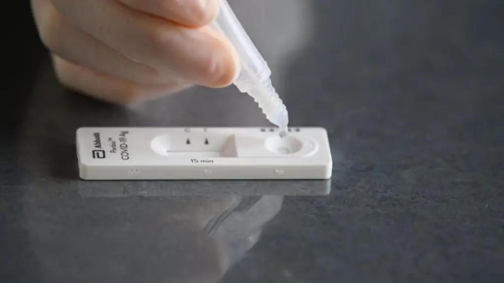 Eine-Loesung-wird-auf-eine-Testkassette-eines-Corona-Schnelltests-aufgetraeufelt