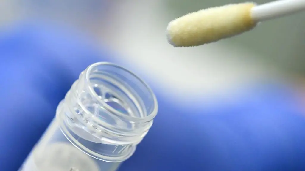 Ein-Abstrich-fuer-das-Testverfahren-auf-das-Coronavirus-ist-zu-sehen