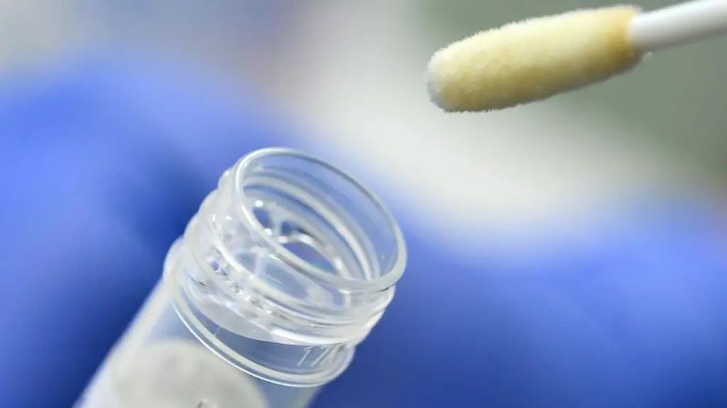 Ein-Abstrich-fuer-das-Testverfahren-auf-das-Coronavirus