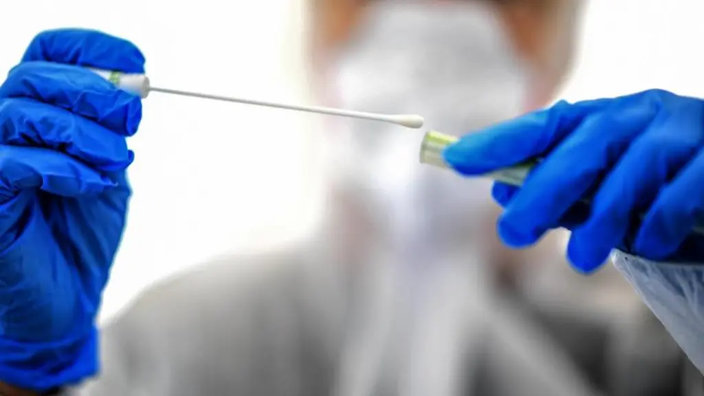 Ein-Abstrichstaebchen-wird-in-einer-ambulanten-Corona-Test-Einrichtung-fuer-die-Analyse-vorbereitet