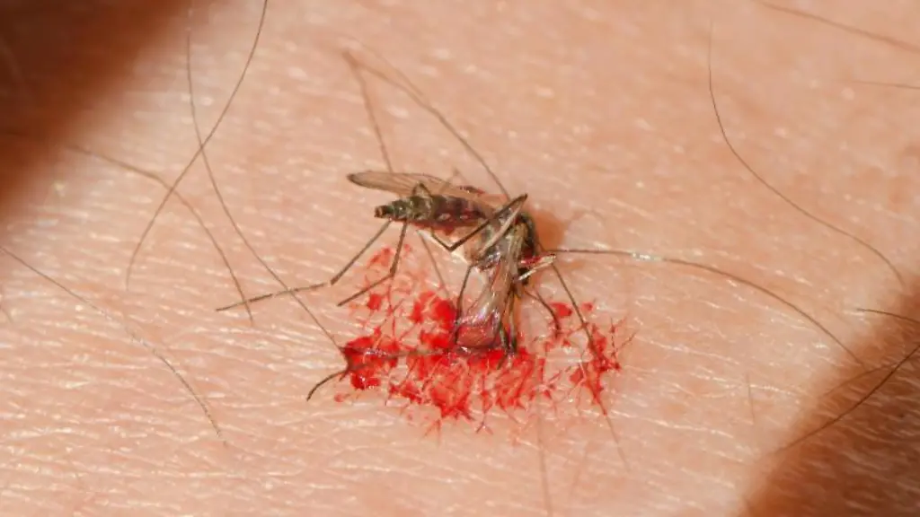 Eine-Muecken-wurde-beim-Stechen-in-die-Haut-eines-Menschen-erschlagen