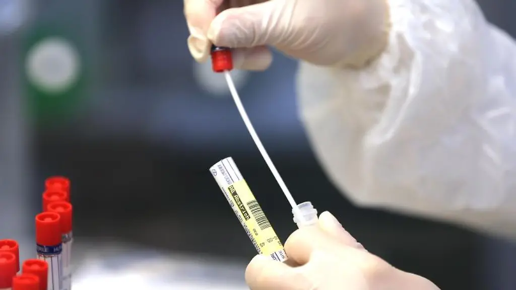 Das-Wattestaebchen-eines-Corona-Abstriches-wird-untersucht