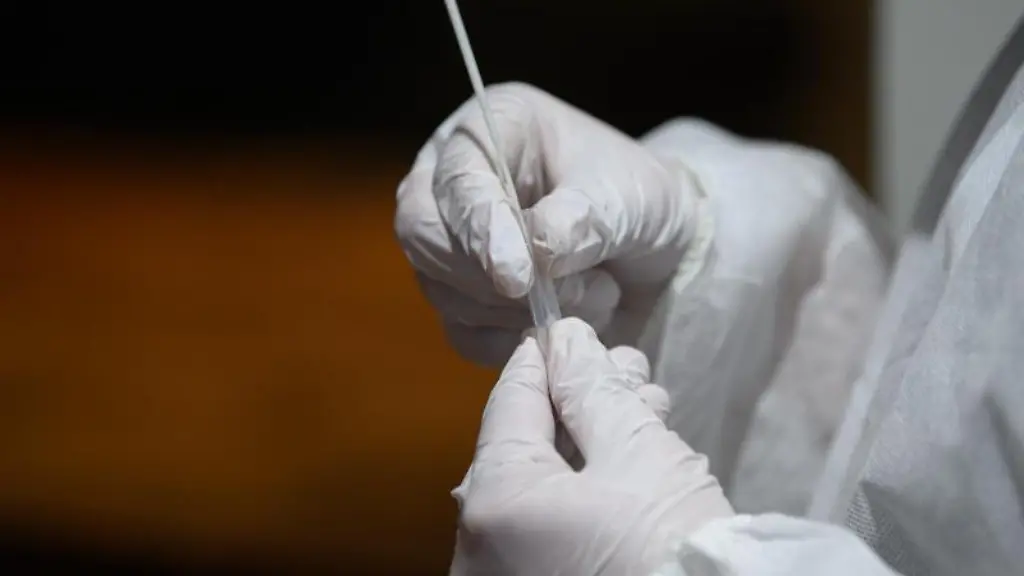 Ein-Corona-Schnelltest-wird-in-einer-Teststation-aufbereitet