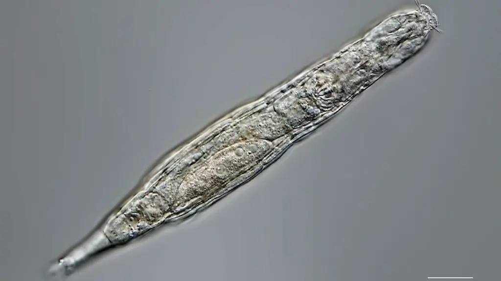 ACHTUNG-Frei-nur-im-Zusammenhang-mit-der-Berichterstattung-ueber-die-Studie