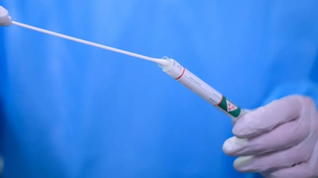 Ein-Arzt-haelt-einen-Coronavirus-Test-in-den-Haenden