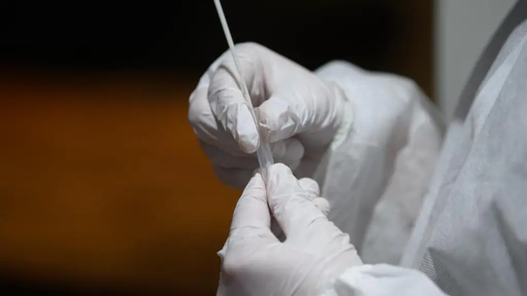 Ein-Corona-Schnelltest-wird-in-einer-Teststation-aufbereitet