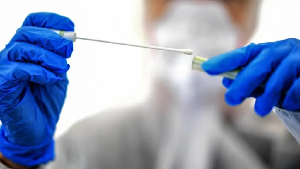 Ein-Abstrichstaebchen-wird-in-einer-Corona-Test-Einrichtung-fuer-die-Analyse-vorbereitet