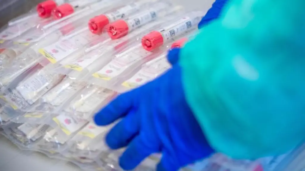 Testsets-mit-Abstrichstaebchen-liegen-in-einem-Testzentrum-fuer-Corona-Verdachtsfaelle