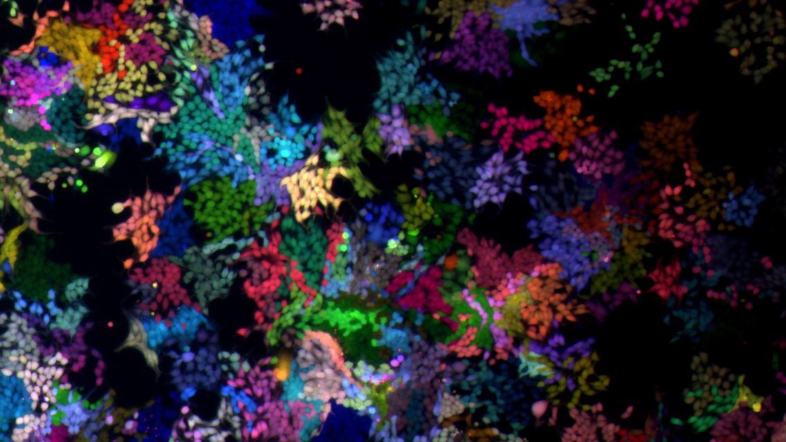 Ein undatiertes Foto, aufgenommen mit einem Fluoreszenz-Mikroskop, zeigt RGB-markierte HEK293T-Zellen in der Kulturschale.