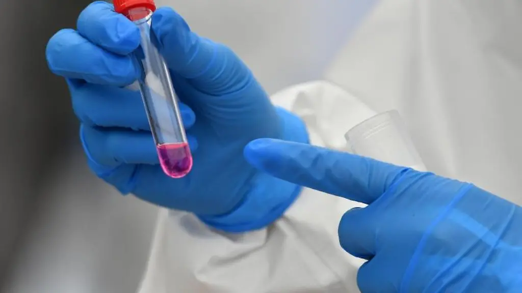 Eine-Laborantin-haelt-einen-Corona-Test-in-der-Hand