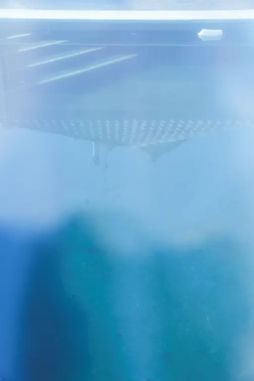 2021-04-12T101007Z-209750561-RC2AUM9W2PGL-RTRMADP-3-HEALTH-CORONAVIRUS-SPAIN-LONGCOVID