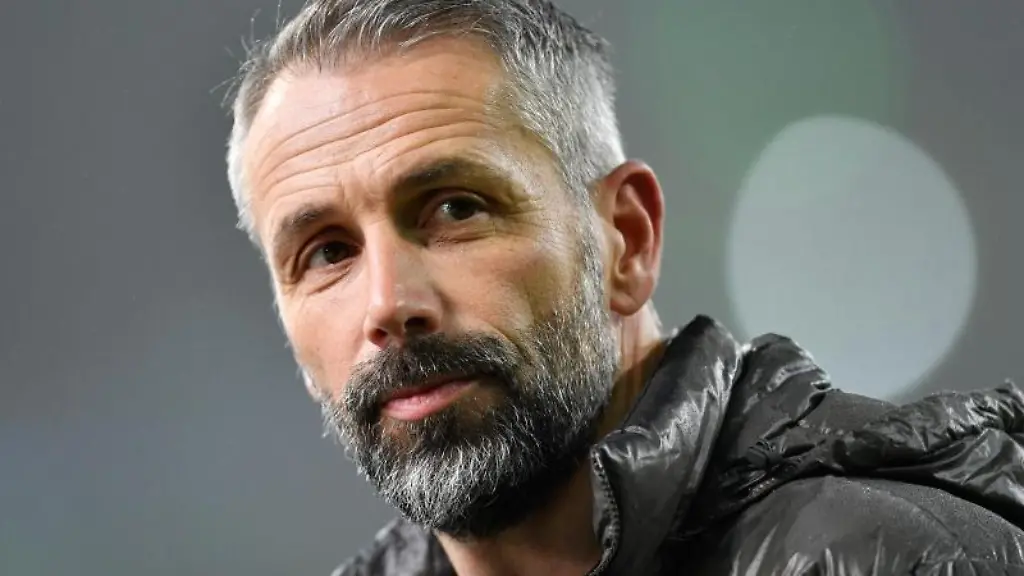 Trainer-Marco-Rose-vor-einem-Spiel