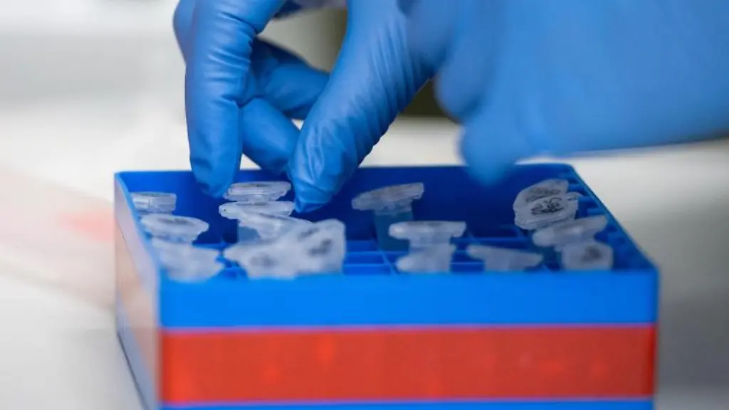 Eine-Laborantin-sortiert-Proben