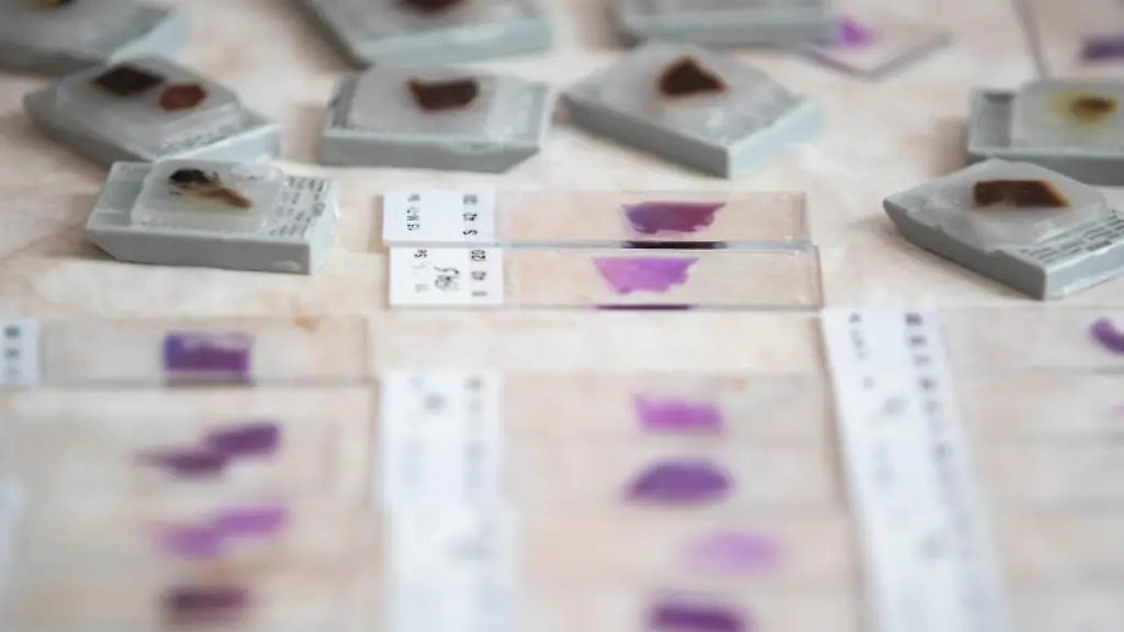 Objekttraeger-fuer-ein-Mikroskop-liegen-auf-einer-Platte