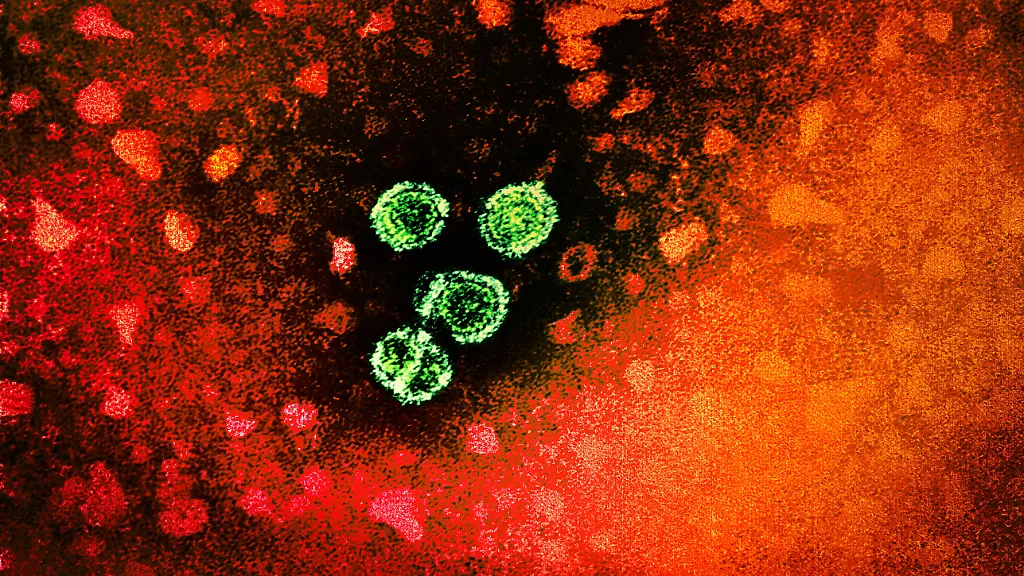 1981-Dr-Erskine-Palmer-This-transmission-electron-micrograph-TEM-revealed-the-presence-of-hepatitis-B-virions-The-large-round-virions-are-known-as-Dane-particles-See-PHIL-10755-for-a-colorized-version-of-this-image-Hepatitis-means-inflammation-of-the-liver-Toxins-certain-drugs-some-diseases-heavy-alcohol-use-and-bacterial-and-viral-infections-can-all-cause-hepatitis-Hepatitis-is-also-the-name-of-a-family-of-viral-infections-that-affect-the-liver-the-most-common-types-in-the-United-States-are-hepatitis-A-hepatitis-B-and-hepatitis-C