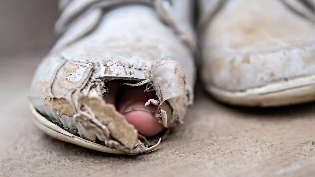 Zeh-schaut-aus-kaputtem-Sportschuh