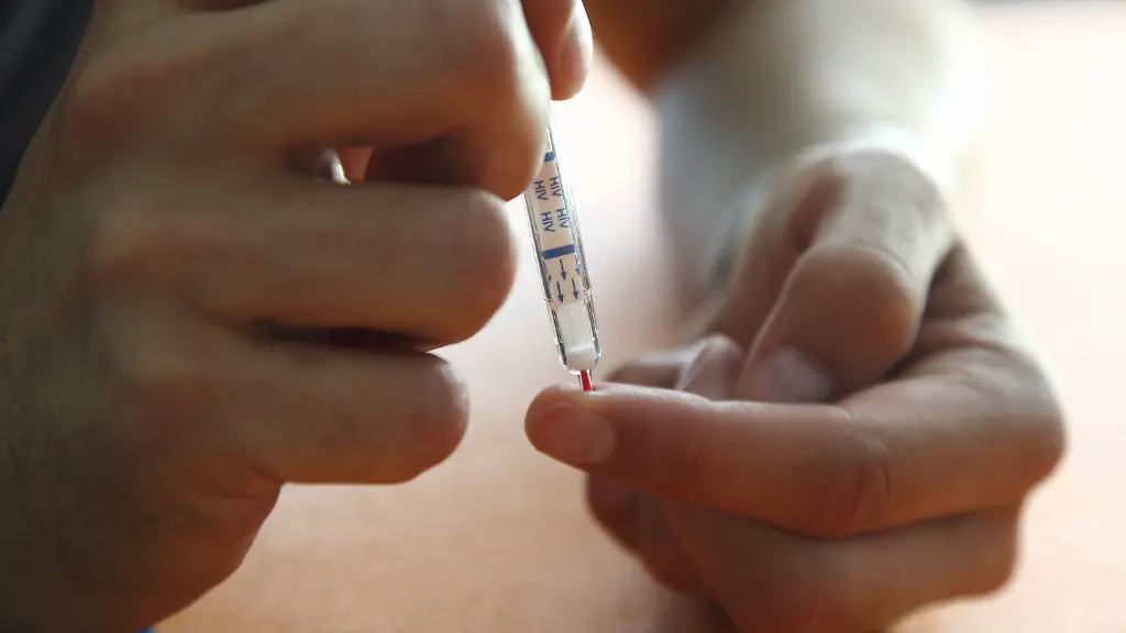 Ab-Herbst-2018-soll-nach-Plaenen-des-Bundesgesundheitsministeriums-jeder-selbst-testen-koennen-ob-er-mit-dem-HI-Virus-infiziert-ist-Foto-HIV-Schnelltest-nach-einem-kleinen-Pieks-in-den-Finger-wird-der-Blutstropfen-auf-ein-Staebchen-aufgetragen-Nach-kurzer-Zeit-zeigt-sich-das-Ergebnis-in-Linienform-Bei-zwei-Linien-liegt-eine-HIV-Infektion-vor-Foto-vom-08-06-2018-Der-HIV-Selbsttest-ist-ein-Meilenstein-beim-Kampf-gegen-Aids-sagte-Gesundheitsminister-Jens-Spahn-CDU-Er-kann-auch-jene-erreichen-die-sich-sonst-nicht-testen-lassen-wuerden-Experten-und-Verbaende-begruessten-die-Plaene-Spahn-zufolge-wissen-schaetzungsweise-13-000-Menschen-in-Deutschland-nichts-von-ihrer-HIV-Infektion-Je-frueher-Betroffene-die-Diagnose-kennen-wuerden-desto-frueher-koennten-sie-gut-behandelt-werden