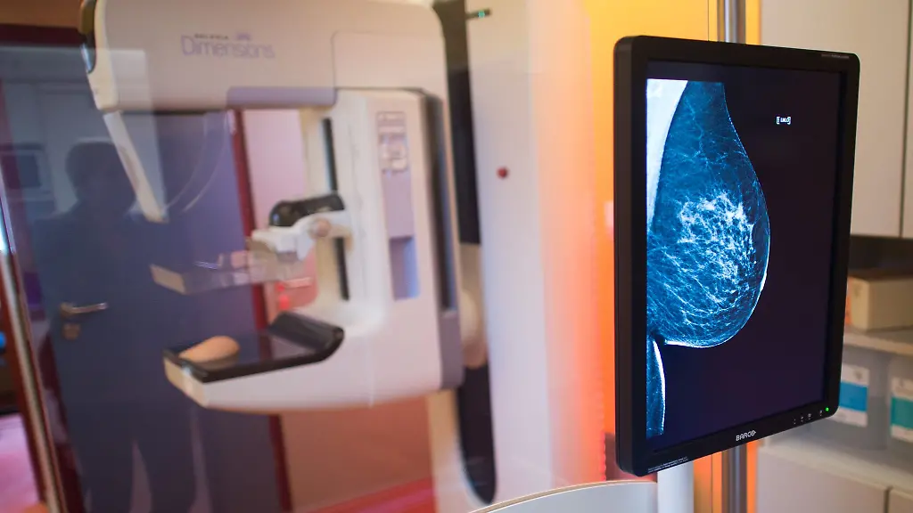 Alle-zwei-Jahre-erhalten-Frauen-zwischen-50-und-75-eine-Einladung-zum-Mammografie-Screening