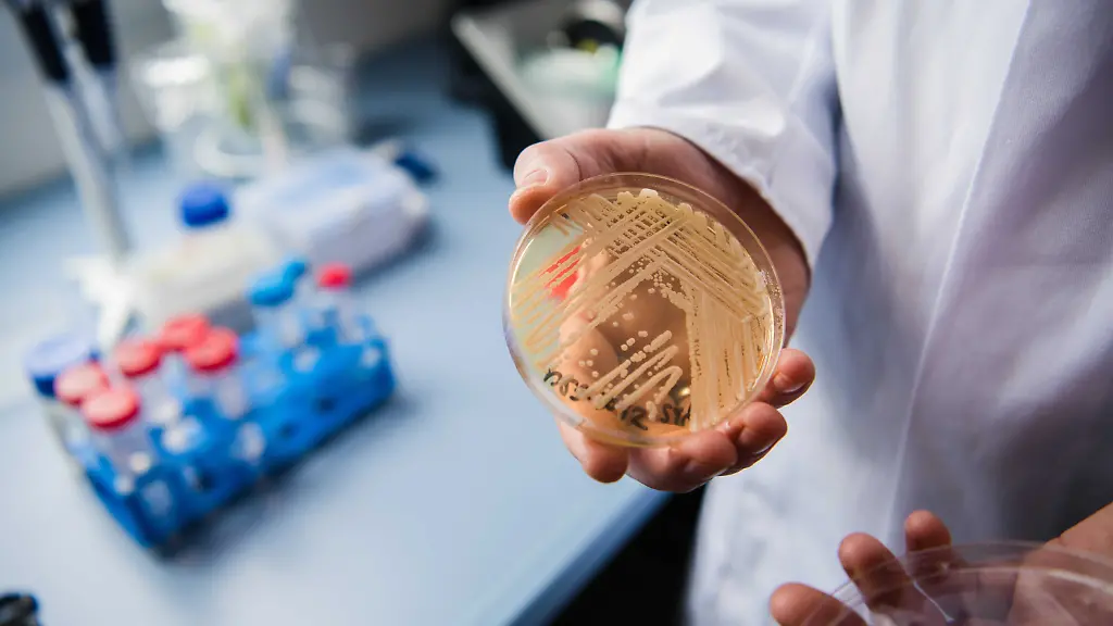 Der-Leiter-des-Nationalen-Referenzzentrums-fuer-invasive-Pilzinfektionen-Oliver-Kurzai-haelt-in-einem-Labor-der-Universitaet-in-Wuerzburg-Bayern-eine-Petrischale-mit-dem-Hefepilz-Candidozyma-auris-frueher-bekannt-als-Candida-auris-in-den-Haenden-In-Deutschland-werden-immer-mehr-Faelle-bekannt-in-denen-schwer-kranke-Patienten-mit-dem-gefaehrlichen-Hefepilz-Candidozyma-auris-frueher-bekannt-als-Candida-auris-infiziert-sind-zu-dpa-Experte-Neu-entdeckter-Hefepilz-ist-bedrohlich-aber-nicht-Ebola-vom-24-01