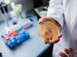 Ansteckung per Schmierinfektion: Ein tödlicher Pilz nistet sich in Europas Krankenhäusern ein