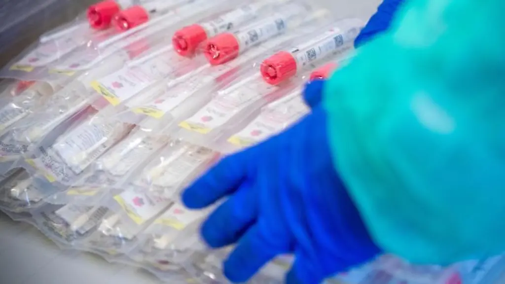 Testsets-mit-Abstrichstaebchen-liegen-in-einem-Testzentrum-fuer-Corona-Verdachtsfaelle