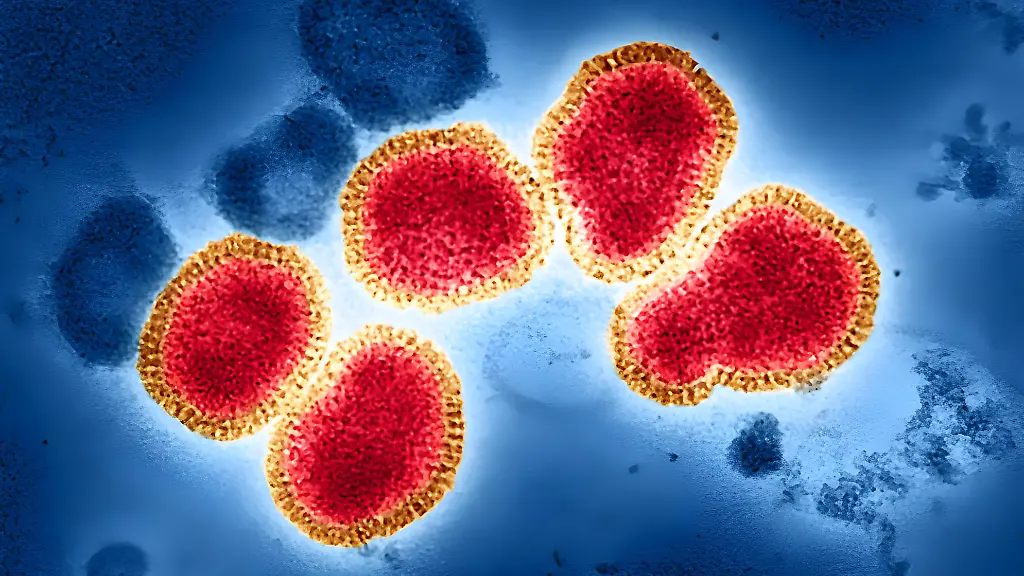 Colorized-transmission-electron-micrograph-of-influenza-A-virus-particles-colorized-red-and-gold-isolated-from-a-patient-sample-and-then-propagated-in-cell-culture-Influenza-A-can-infect-both-humans-and-animals-including-birds-and-pigs-More-specifically-this-image-features-the-H3N2-influenza-strain-isolated-from-a-patient-in-Victoria-Australia-in-1975-Notable-for-forming-both-spherical-particles-virions-pictured-and-filamentous-virions-this-historical-strain-can-be-employed-to-study-the-breadth-of-the-immune-response-elicited-by-universal-flu-vaccine-candidates-Microscopy-by-John-Gallagher-and-Audray-Harris-NIAID-Laboratory-of-Infectious-Diseases-Credit-NIAID