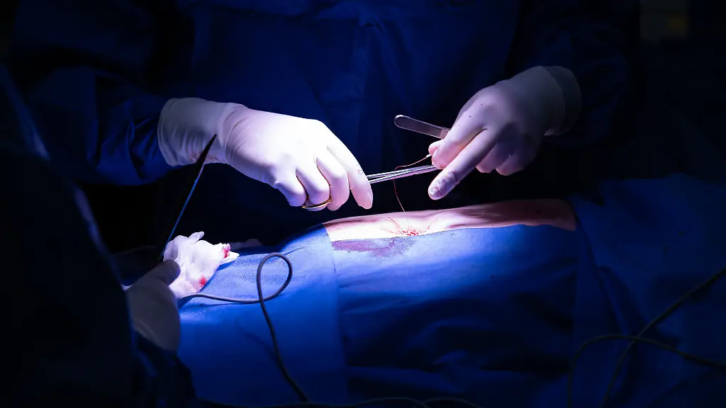 In-einem-Operationssaal-vernaeht-der-Operateur-kleine-Schnitte-die-er-in-die-Bauchdecke-fuer-einen-minimalinvasiven-Eingriff-gesetzt-hat-zu