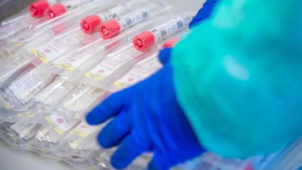 Testsets-mit-Abstrichstaebchen-liegen-in-einem-Testzentrum-fuer-Corona-Verdachtsfaelle