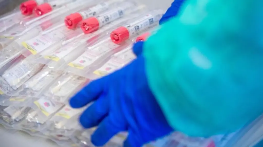 Testsets-mit-Abstrichstaebchen-liegen-in-einem-Testzentrum-fuer-Corona-Verdachtsfaelle