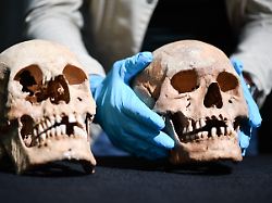 Rektorin bittet um Verzeihung: Einbrecher stehlen wichtigen Schädel aus Anatomie der Uni Köln