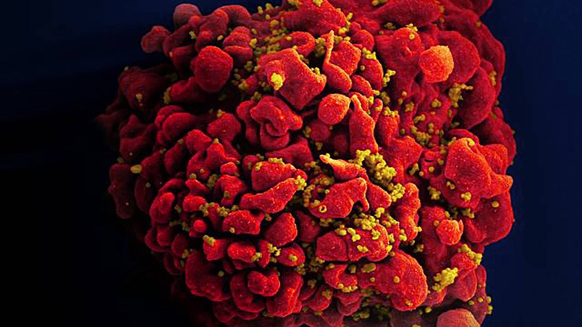 Von-Sp-tdiagnosen-Stigma-und-Hoffnung-HIV-ist-genauso-eine-Infektion-wie-Corona-