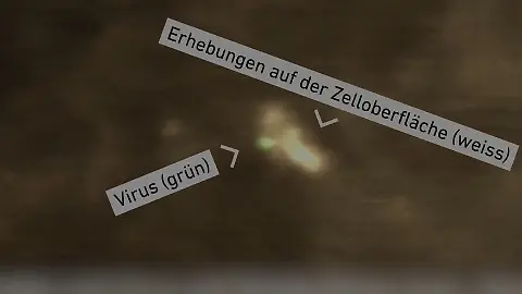 Viren_Video