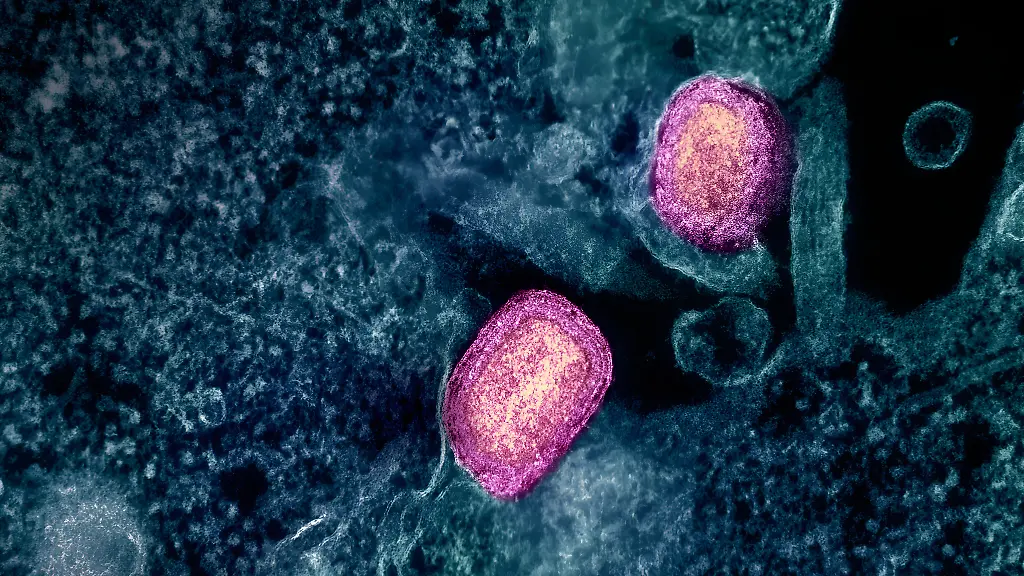 Colorized-transmission-electron-micrograph-of-two-mature-mpox-virus-particles-pink-attached-to-the-surface-of-an-infected-VERO-E6-cell-blue-teal-Image-captured-at-the-NIAID-Integrated-Research-Facility-in-Fort-Detrick-Maryland-Credit-NIAID-NIH