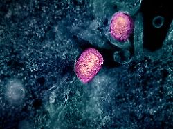 Gefahr durch Virus-Mutante?: Neue hybride Mpox-Variante in Großbritannien entdeckt