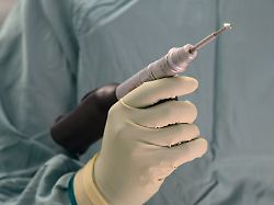 Bohrte sie Loch in Schädel?: Zwölfjährige am OP-Tisch: Gericht spricht Chirurgen frei