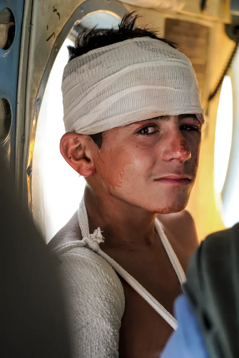 An-injured-boy-sits-quietly-after-a-powerful-earthquake-in-Kunar-province-eastern-Afghanistan-on-September-1-2025-His-wounds-reflect-the-human-cost-of-the-disaster-that-has-left-hundreds-dead-and-thousands-injured-as-emergency-teams-work-to-provide-aid-amid-the-widespread-destruction