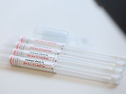 Sachsen-Anhalt: Vertrauliche Spurensicherung - Angebot für Gewaltopfer