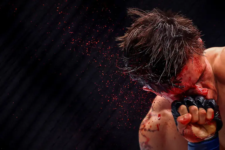 Mixed-Martial-Arts-UFC-Fight-Night-Lone-er-Kavanagh-v-Felipe-dos-Santos-O2-Arena-London-Britain-March-22-2025-Lone-er-Kavanagh-in-action-against-Felipe-dos-Santos-during-their-flyweight-bout-Action-Images-via-Reuters-Andrew-Boyers-TPX-IMAGES-OF-THE-DAY-SEARCH-REUTERS-BEST-SPORTS-2025-FOR-THIS-STORY-SEARCH-REUTERS-YEAR-END-FOR-ALL-2025-YEAR-END-GALLERIES