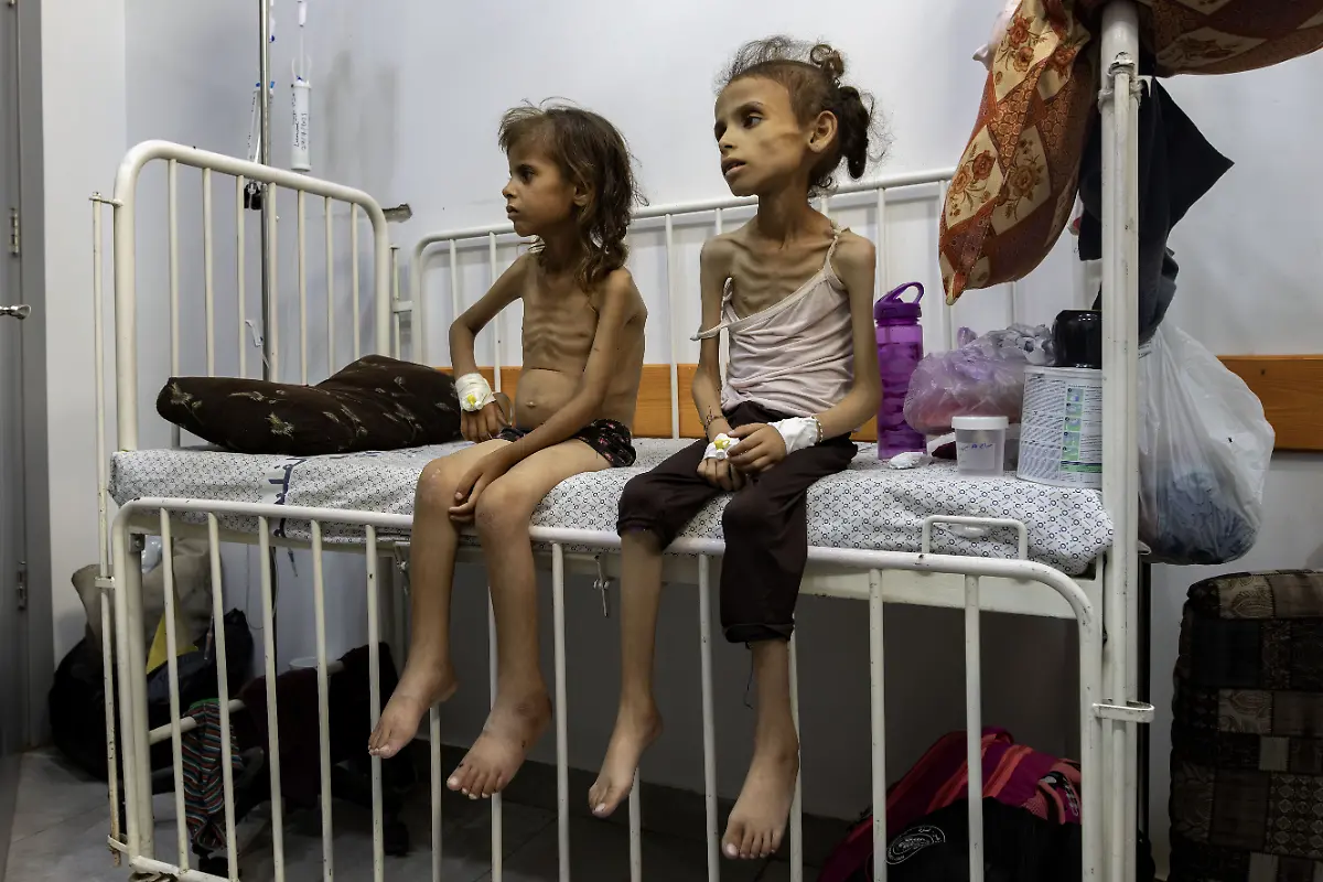 PLEASE-DO-NOT-USE-WITHOUT-APPROVAL-FROM-GAIA-TRIPOLI-NYTCEASEFIRE-August-4-2025-Gaza-City-Maryam-Dawas-9-years-old-Her-mother-Mudalla-Dawas-says-Maryam-suffers-from-severe-malnutrition-and-has-never-suffered-from-any-illness-before-She-was-previously-healthy-weighing-25-kilograms-but-her-condition-worsened-with-the-onset-of-the-famine-two-months-ago-She-says-she-weighed-11-kilograms-a-week-ago-and-now-weighs-9-kilograms-Maryam-remains-in-the-malnutrition-ward-at-Friends-of-the-Sick-Hospital-in-central-Gaza-City