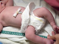 Thüringen: Erste Hebammen kündigen wegen neuer Vergütungsregeln