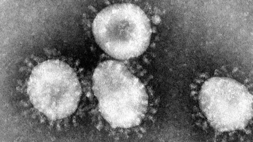Ein-Coronavirus-unter-dem-Mikroskop