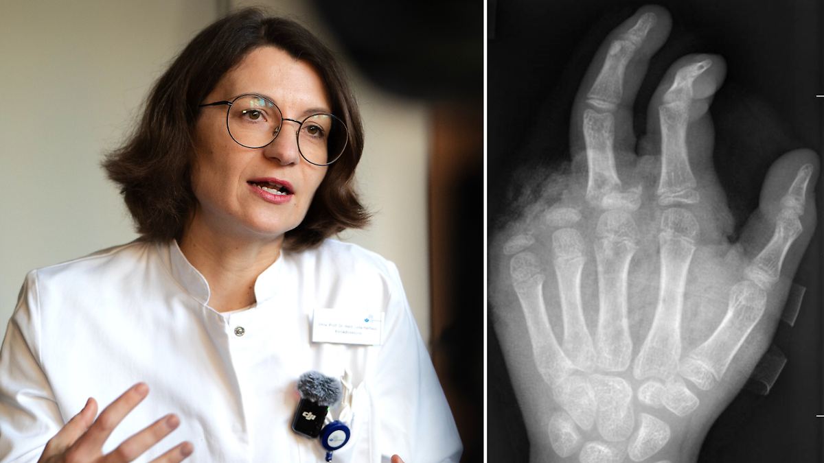 -Arbeitsreichste-Nacht-Handchirurgin-B-llerverletzungen-werden-schlimmer