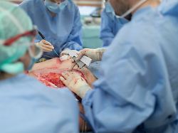 "Die große Herausforderung": Wie bei Brandverletzungen komplex behandelt wird