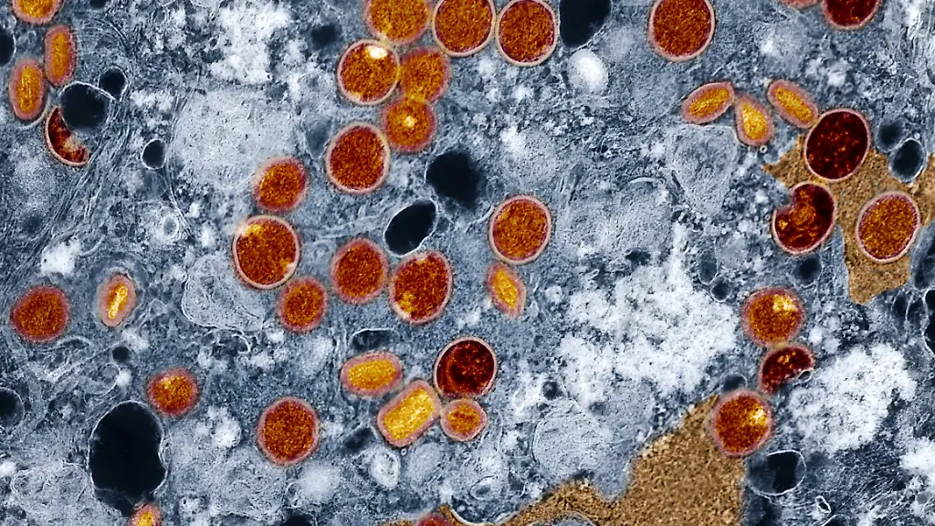 Colorized-transmission-electron-micrograph-of-mpox-virus-particles-red-and-yellow-found-within-infected-VERO-E6-cells-blue-The-virus-particles-are-in-various-stages-of-maturity-which-accounts-for-differences-in-shape-This-image-also-features-virus-factories-brown-which-are-inclusions-within-infected-cells-where-virus-replication-maturation-and-assembly-occurs-Credit-NIAID