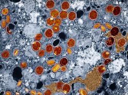 Infektiologe warnt vor Erregern: Diese Viren könnten uns 2026 gefährlich werden