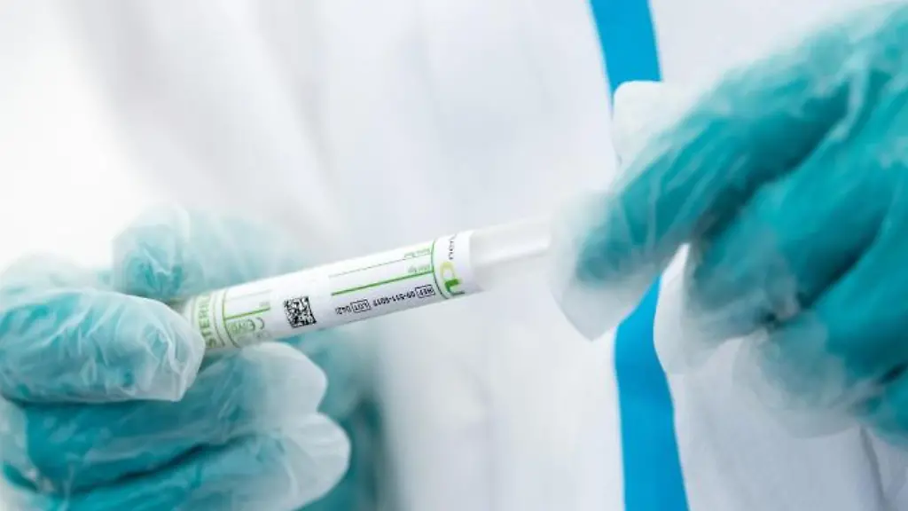 Ein-Mitarbeiter-haelt-ein-Testroehrchen-in-den-Haenden