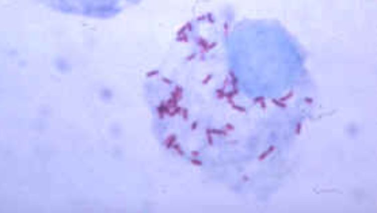 Eine mikroskopische Aufnahme des Rickettsia rickettsii in seiner Wirtszelle.