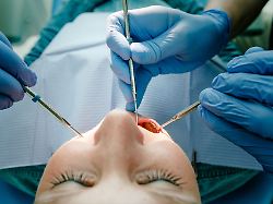 Sozialfragen im Trendbarometer : Beim Zahnersatz verstehen die Befragten keinen Spaß