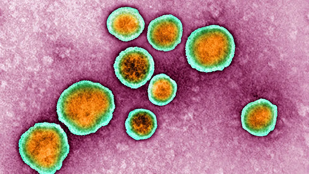 RSV-Respiratory-Syncytial-Virus-Image-produced-using-high-dynamic-range-imaging-HDRI-from-an-image-taken-with-transmission-electron-microscopy-Viral-diameter-between-150-400-nm